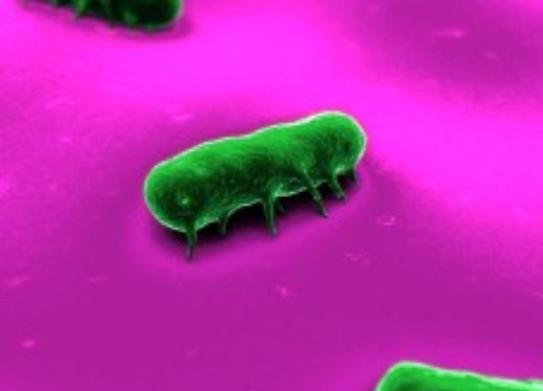 Virus Superbug NDM-1