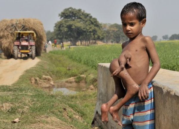 dječak sa osam udova