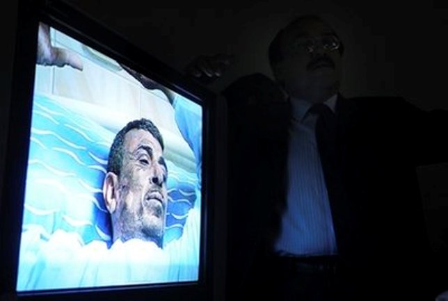 Egipćanin koji se zapalio