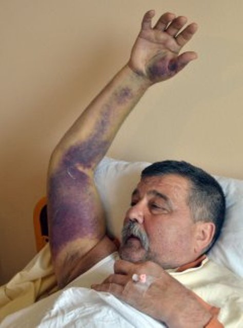 Preživio ujed &scaron;arke: Miodrag Krsmanović