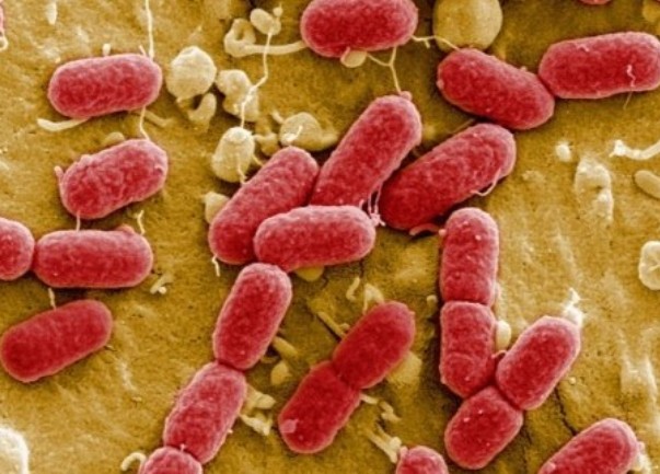 E. coli