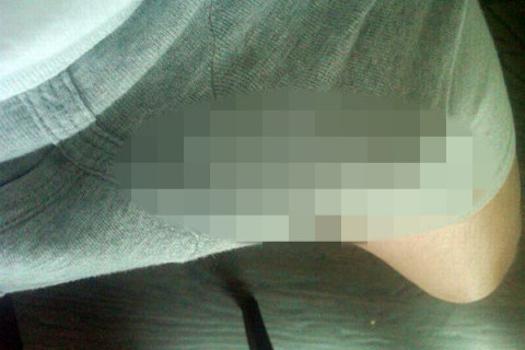 neprimjerena slika Anthony Weinera