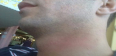 avdo avdic prebijen 2