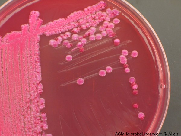 Escherichia coli
