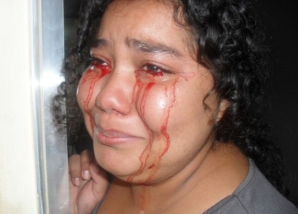 Deborah Oliveira dos Santos plače krv