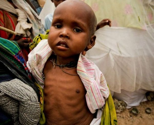 Somalija dijete
