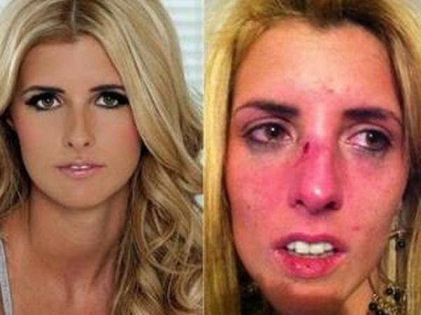 pretucena runijeva ljubavnica pretucena runijeva ljubavnica