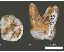 zub denisovaca zub denisovaca