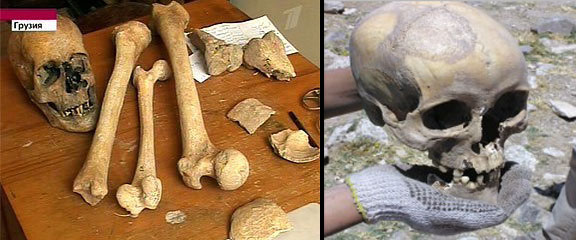 divovske kosti divovske kosti