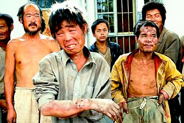 Neki od tih oslobođenih robova bili su slijepi i nijemi, dok drugi nisu bili u stanju da kažu gdje su prije živjeli; foto: Asianews.it