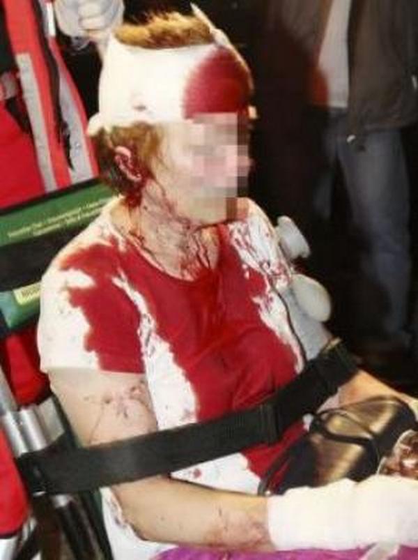 napao_djevojku_sjekirom