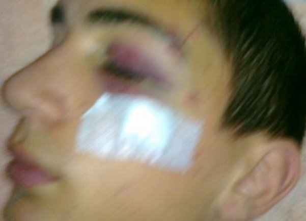 pretuceni djecak novi sad pretuceni djecak novi sad