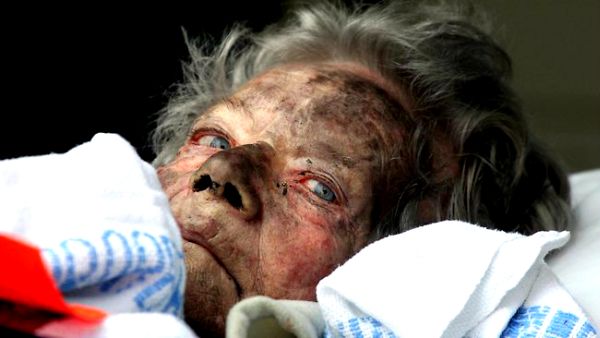 Jedna od povrijeđenih stanarki doma na putu za bolnicu; foto: The Daily Telegraph Jedna od povrijeđenih stanarki doma na putu za bolnicu; foto: The Daily Telegraph