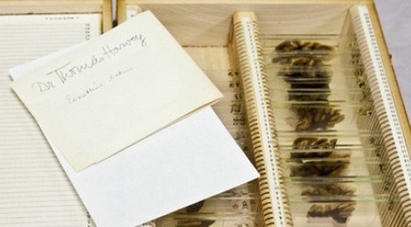 Mozak slavnog fizičara Alberta Einsteina Mozak slavnog fizičara Alberta Einsteina