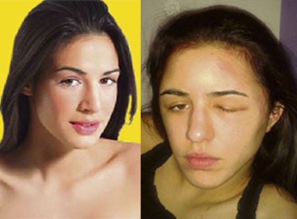 KatarinA Prlinčević