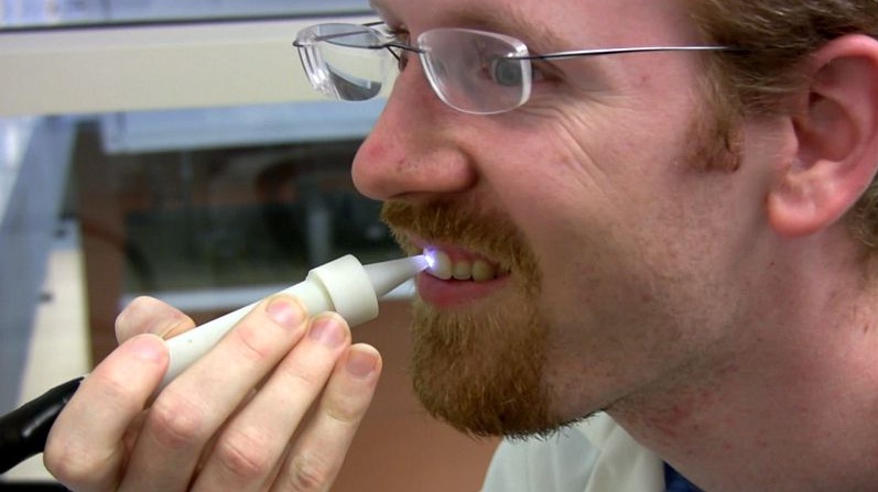 plazma četkica protiv karijesa