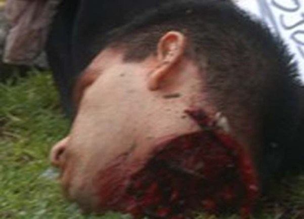 Pronađena odsječena glava u Los Angelesu