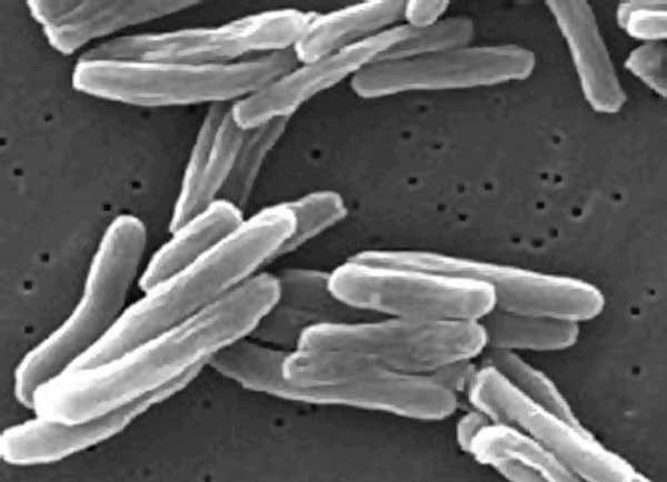 tuberkuloza bakterija