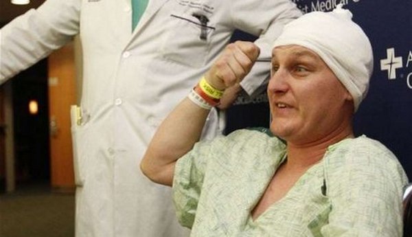 Mu&scaron;karac 24 časa proveo sa 8,8 centimetara dugim ekserom u glavi