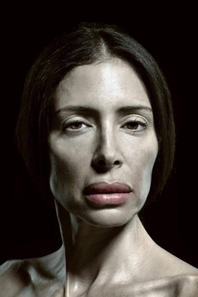 Portreti ekstremnih slučajeva plastične hirurgije