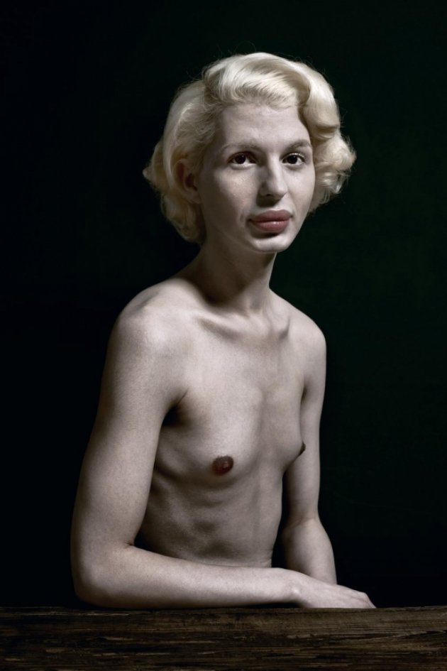 Portreti ekstremnih slučajeva plastične hirurgije