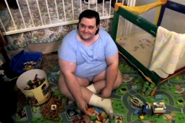 Ima 31 godinu, a živi kao beba Ima 31 godinu, a živi kao beba