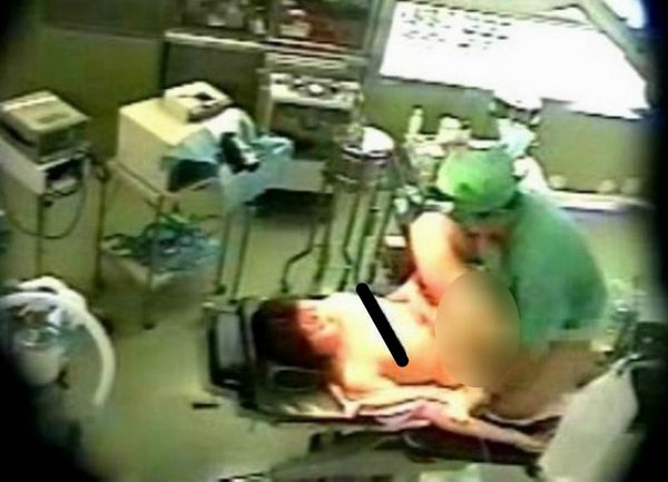 SILOVANJE ANESTEZIOLOG1 SILOVANJE ANESTEZIOLOG1