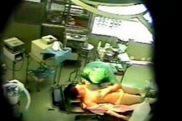 SILOVANJE ANESTEZIOLOG2 SILOVANJE ANESTEZIOLOG2