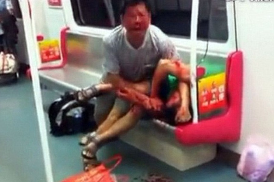 kinez izgrizao dječaka