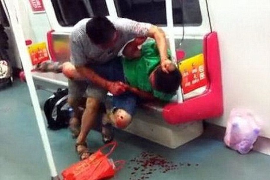 kinez izgrizao dječaka