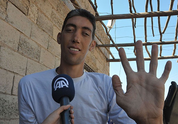 Najvi&scaron;i čovjek na svijetu prestao da raste