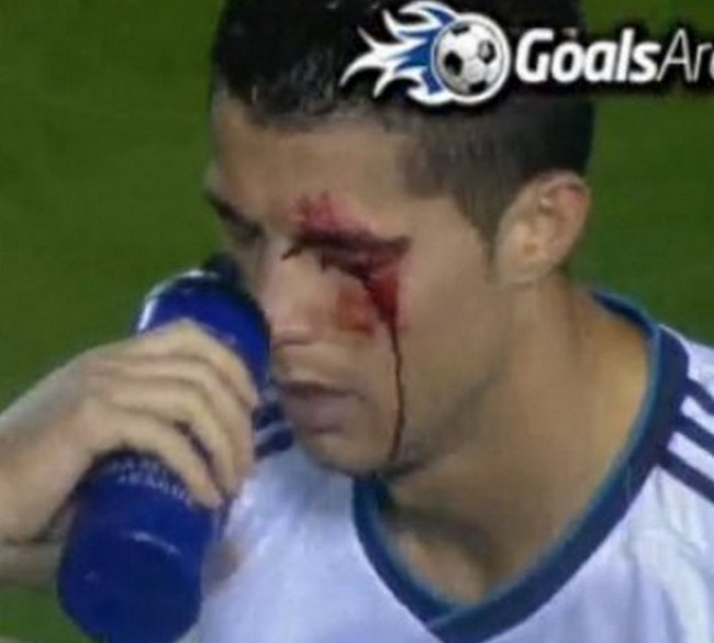 igrač Levantea razbio arkadu Cristianu Ronaldu igrač Levantea razbio arkadu Cristianu Ronaldu