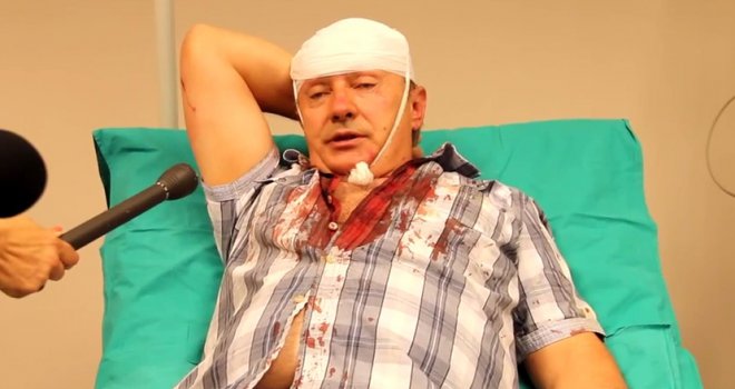 Pronađen automobil napadača na akademika Kukića