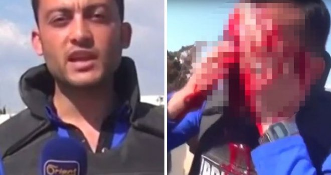 Uznemirujući snimak: Vodio program uživo, a onda ga je geler pogodio u glavu...