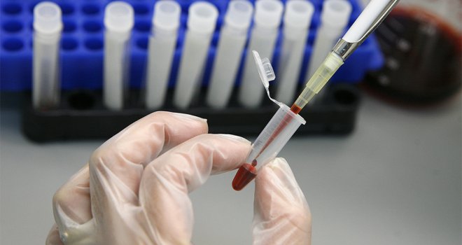 Moramo poduzeti mjere štednje u domovima zdravlja, 75 posto pretraga nije bilo potrebno uraditi!