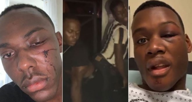 Brutalni napad u Zadru: Grupa muškaraca u noćnom klubu pretukla dvojicu tamnoputih američkih gay vojnika