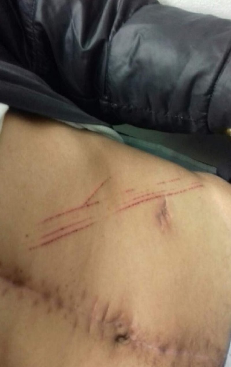 rvi-silovanje-odzak2