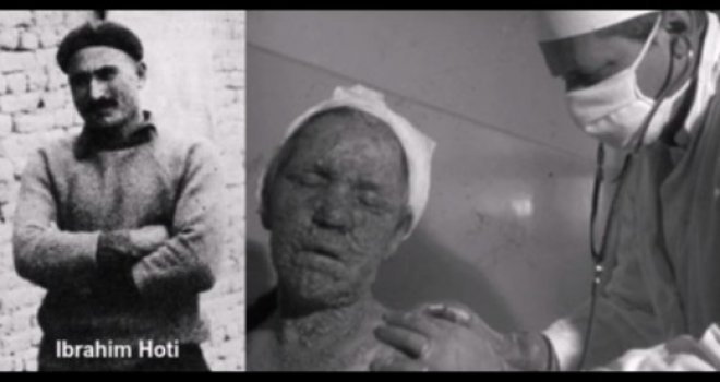Epidemija koja je poharala svijet 1972. izbila u Jugoslaviji: Ibrahim virus donio sa hadža, ljudi umirali u teškim mukama