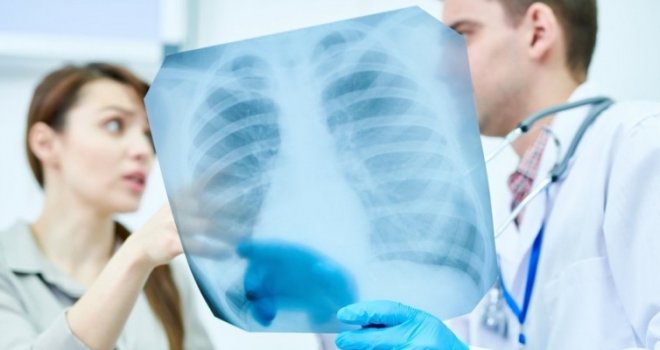 Uvjeravali su nas da su sigurni, a kancerogeni su: Sadrže teške metale i herbicide, a najveću štetu rade jetri i plućima