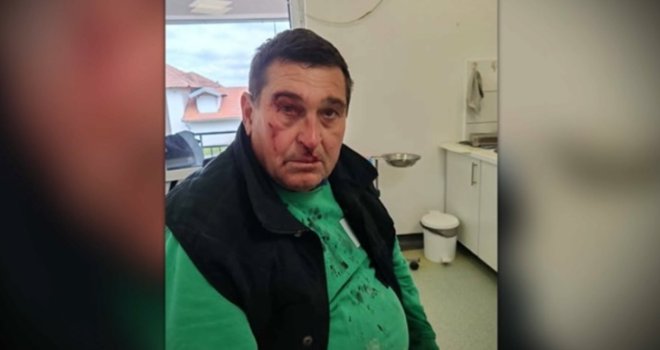 Otac i sin pretučeni u Srbiji nakon što su mitingašima SNS-a doviknuli 'pumpaj, pumpaj', otac završio u bolnici
