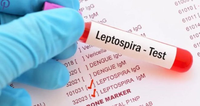 Nove informacije o leptospirozi u KS, evo koliko je zaraženih, a koliko hospitalizovanih