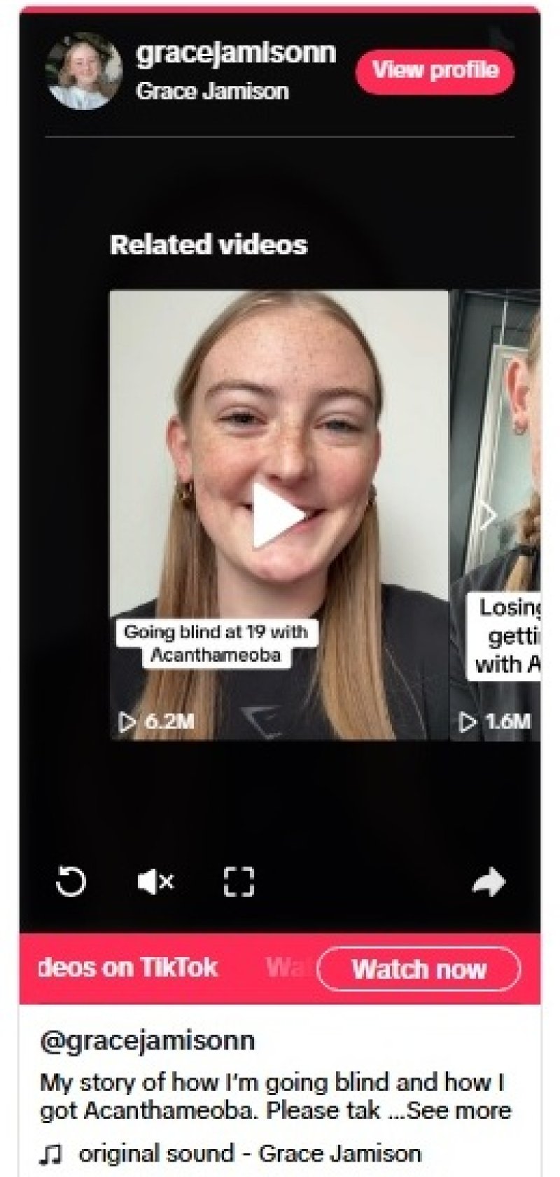 paraziti-tusiranje-lece