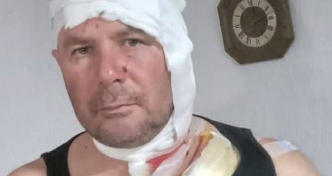 Lovac iz BiH preživio krvavi okršaj sa dva medvjeda: 'Zarila mi je nokte u glavu!'